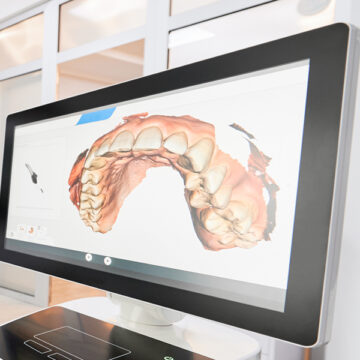 Oral Cancer Screenings