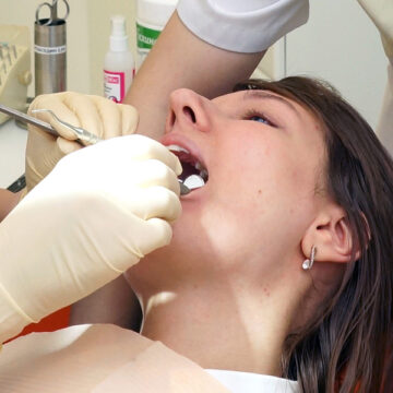 Tooth Extractions